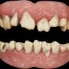 Morris Zombie Teeth -Halloween Horror Decorations Shop zombie teeth 14161070948400